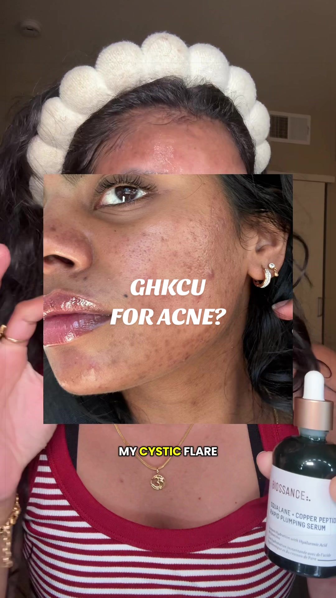 @Nyx Curations | Acne +Wellness