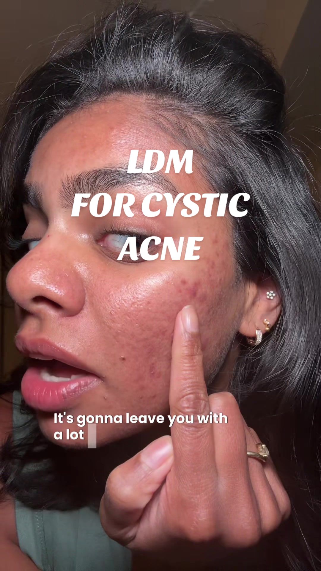 @Nyx Curations | Acne +Wellness