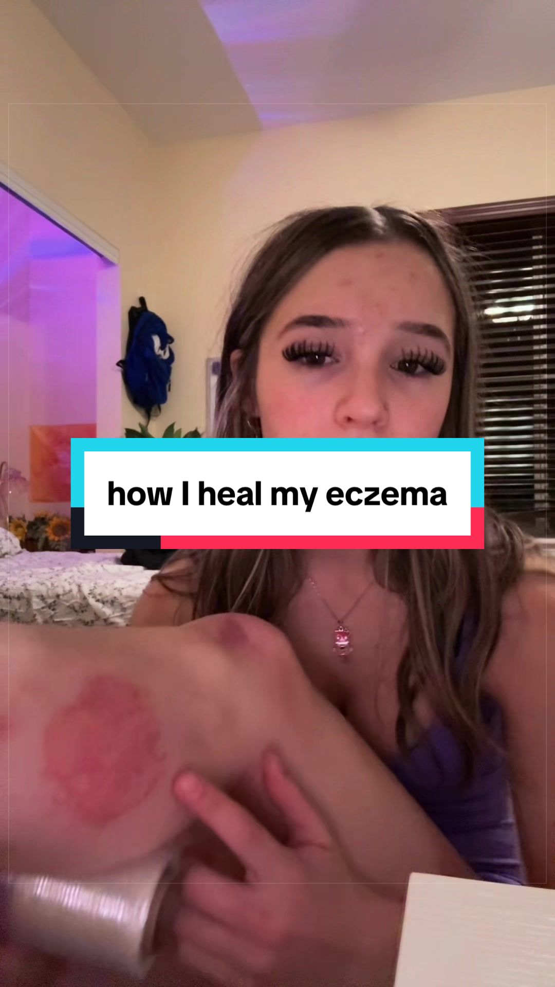 @lei