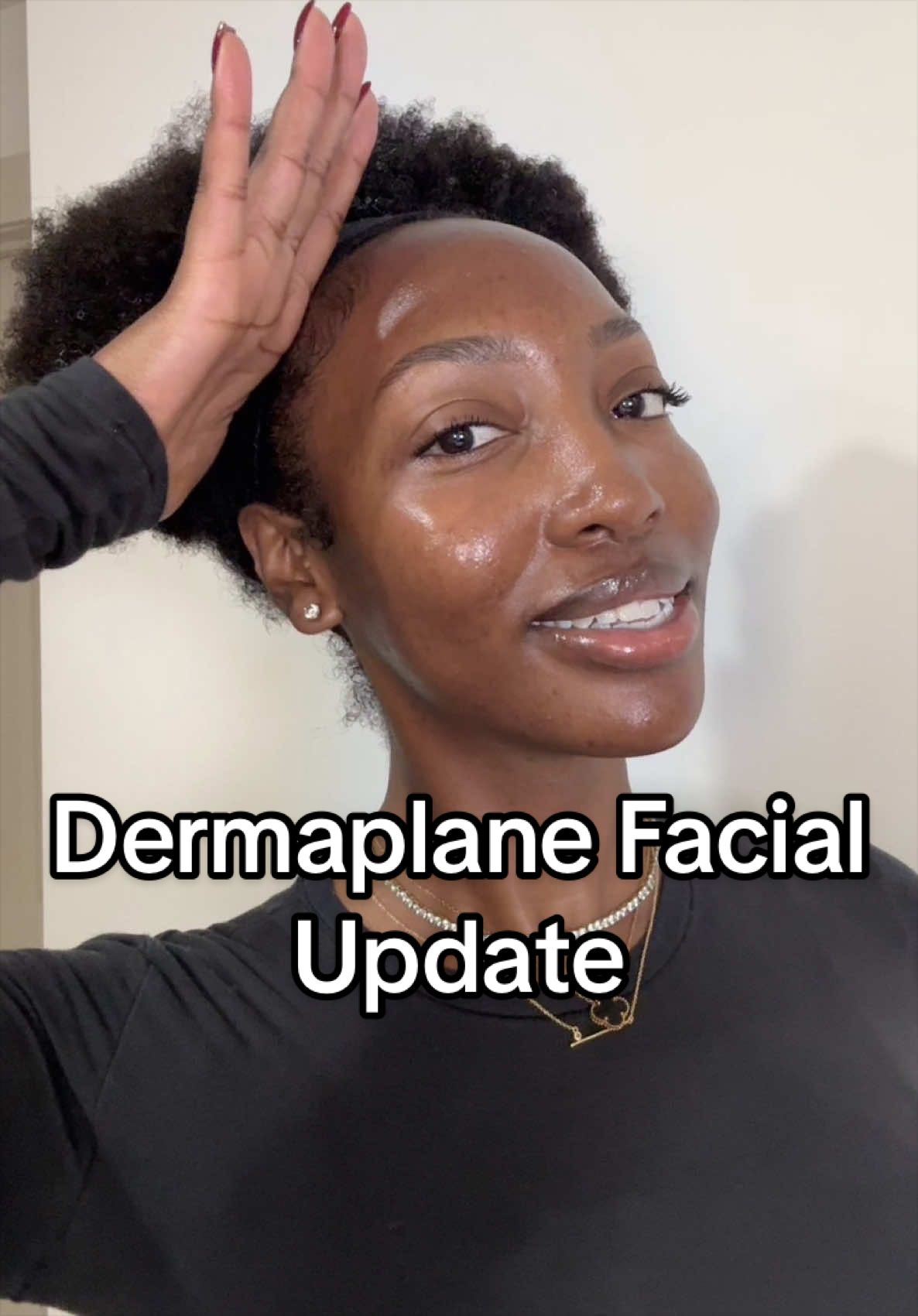 @Alexus