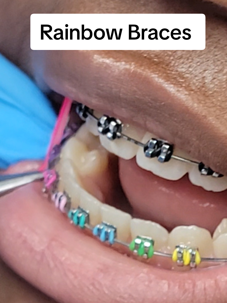 @SmileEnvyDental