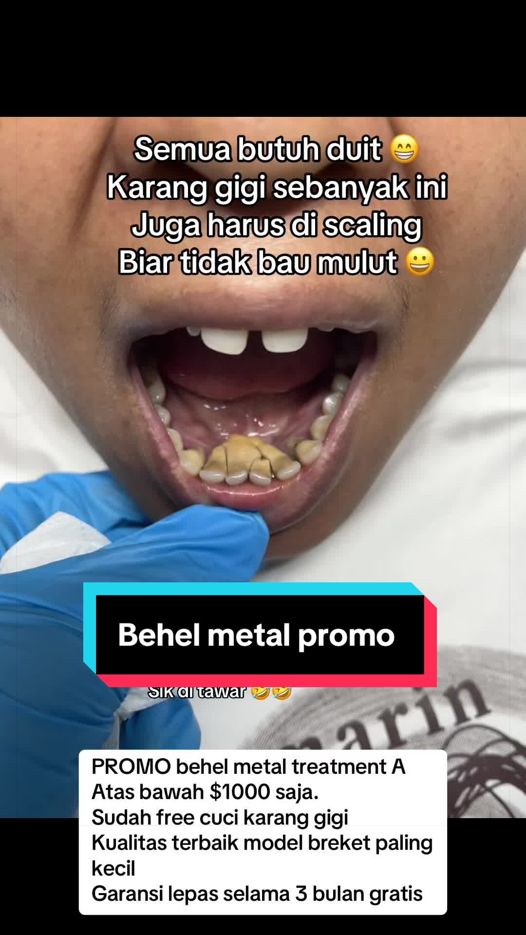 @mbak-Paijem