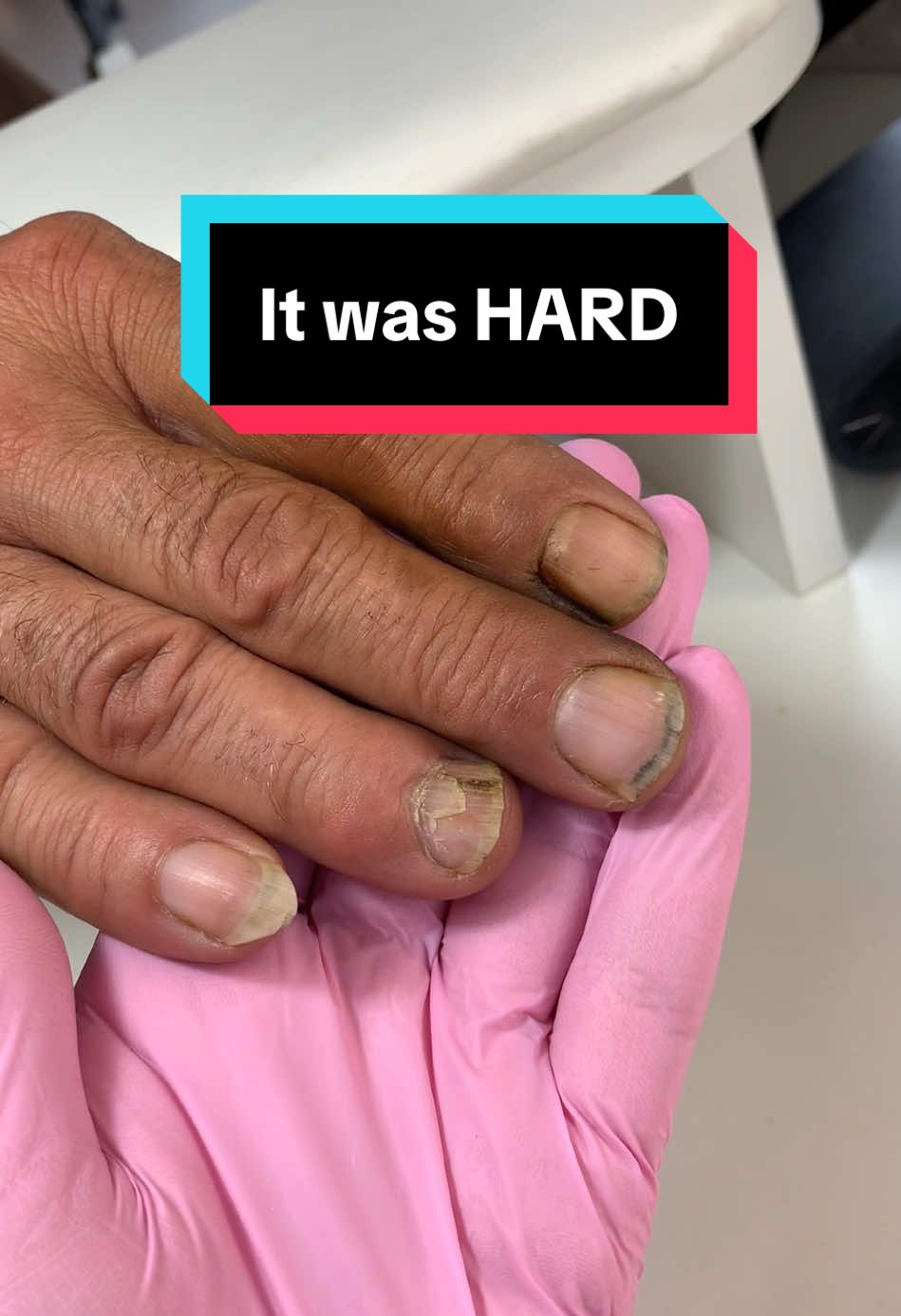 @nailcou