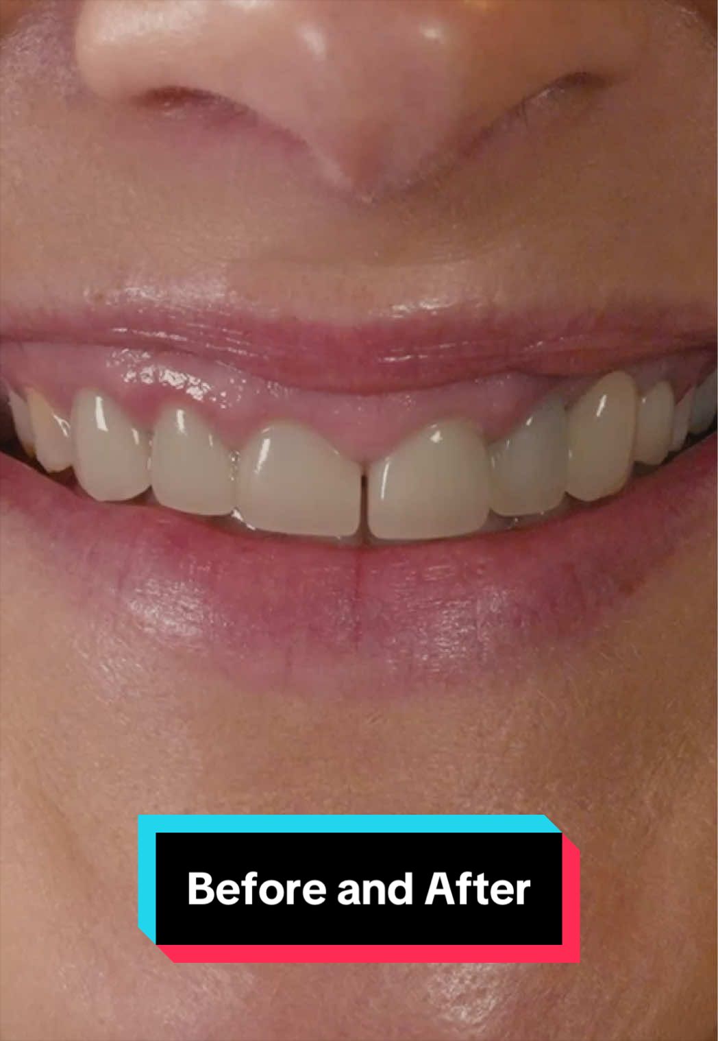 @austincosmeticdentistry