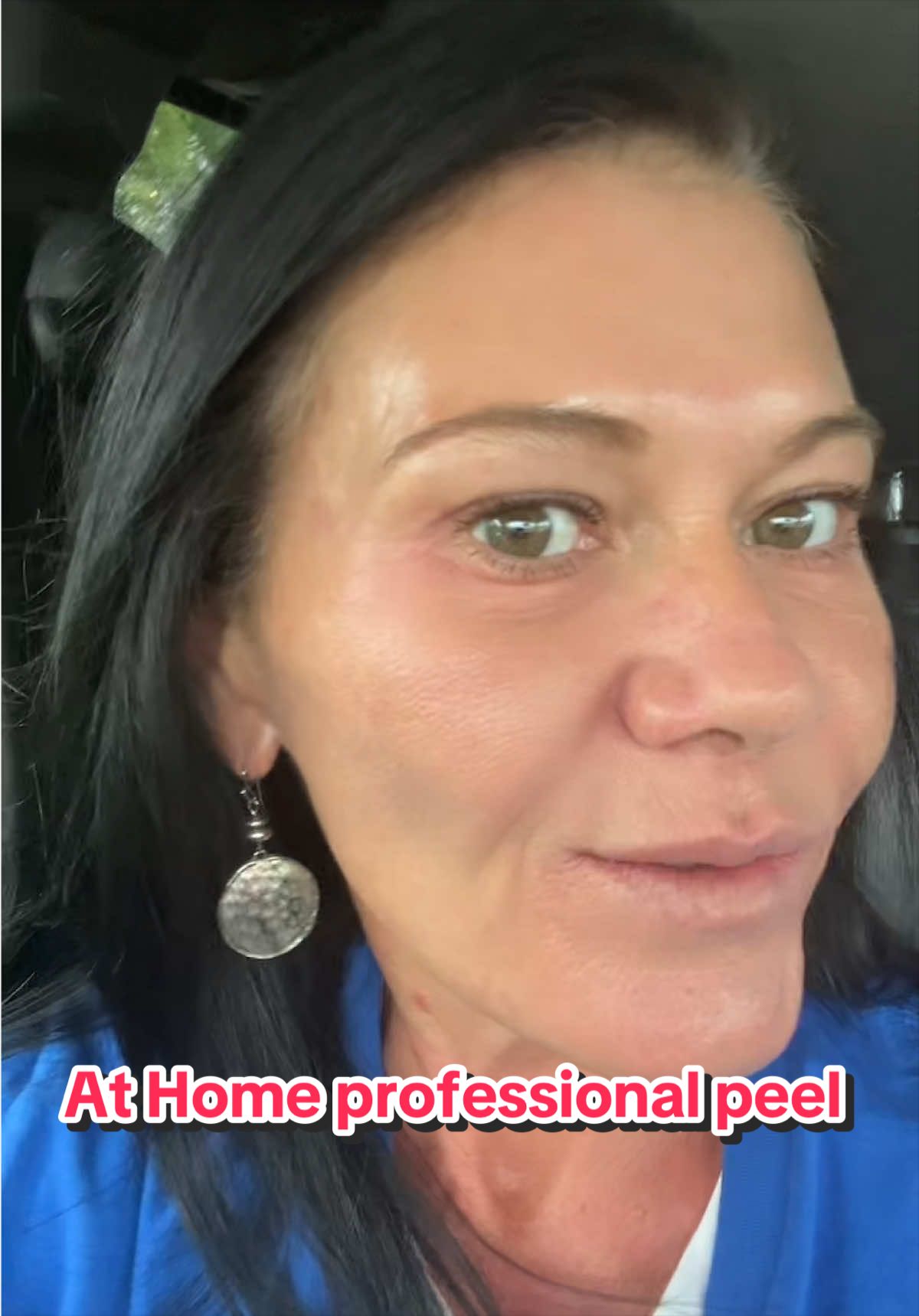 @Kristen D