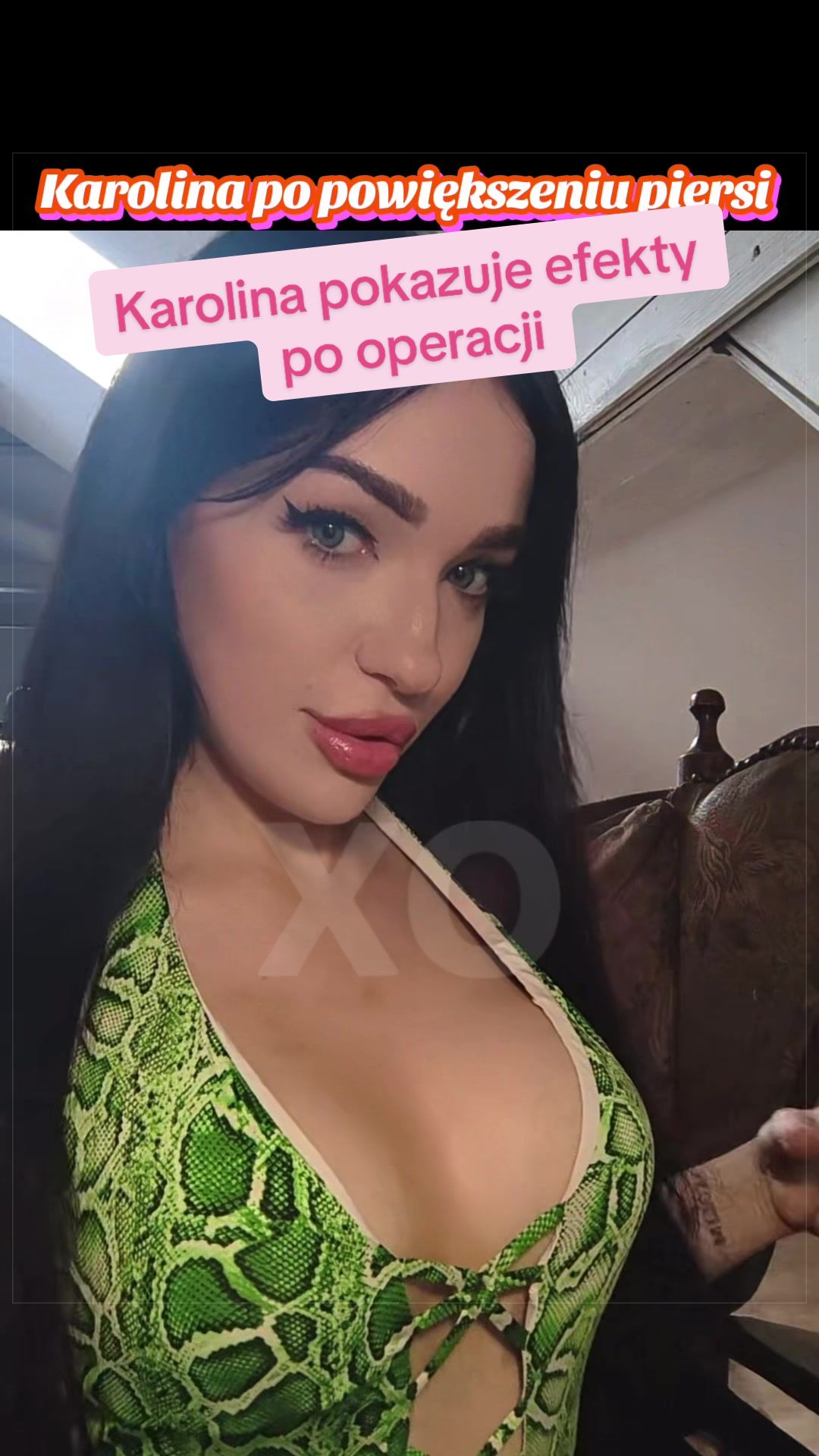 @linkaxo