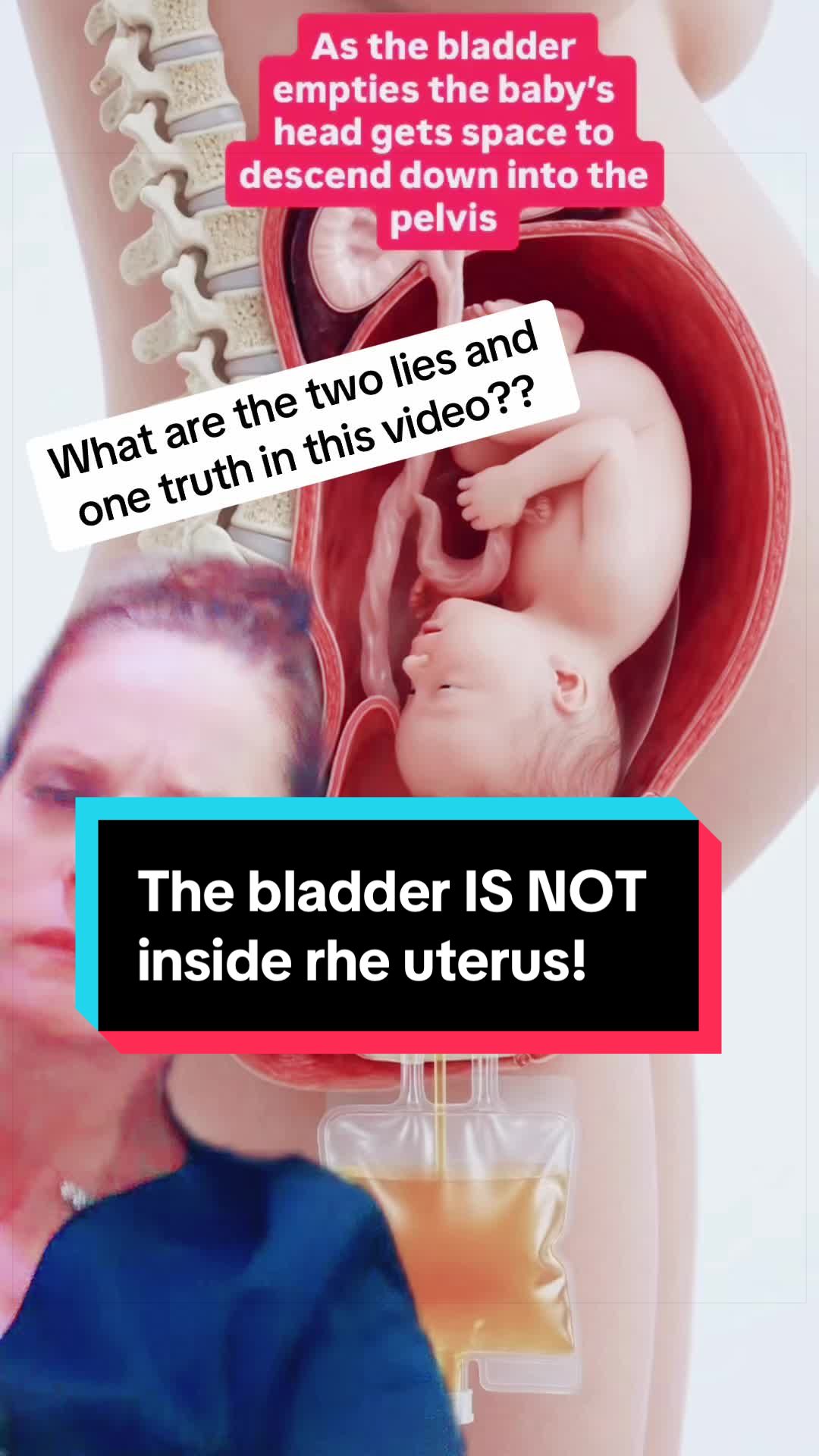 @Shannon M. Clark, MD, FACOG