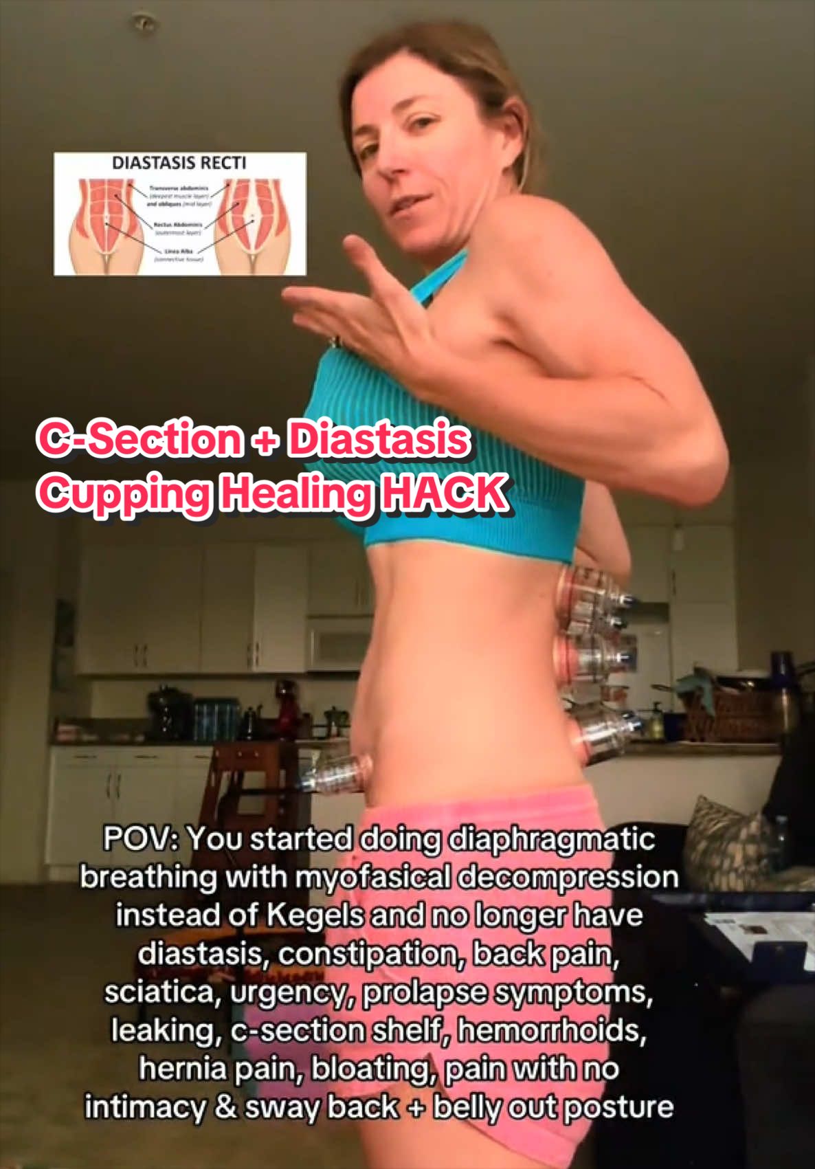 @Dr. Kelly Peterson PT,DPT,PRPC