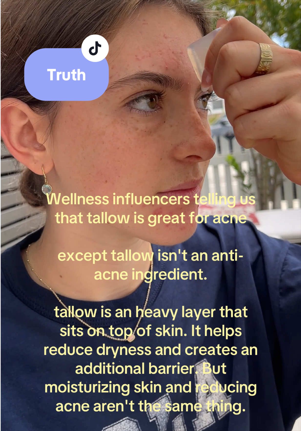 @dewmighty