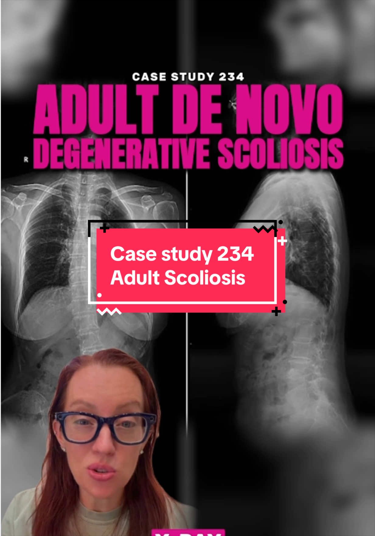 @Ladyspinedoc⚡️