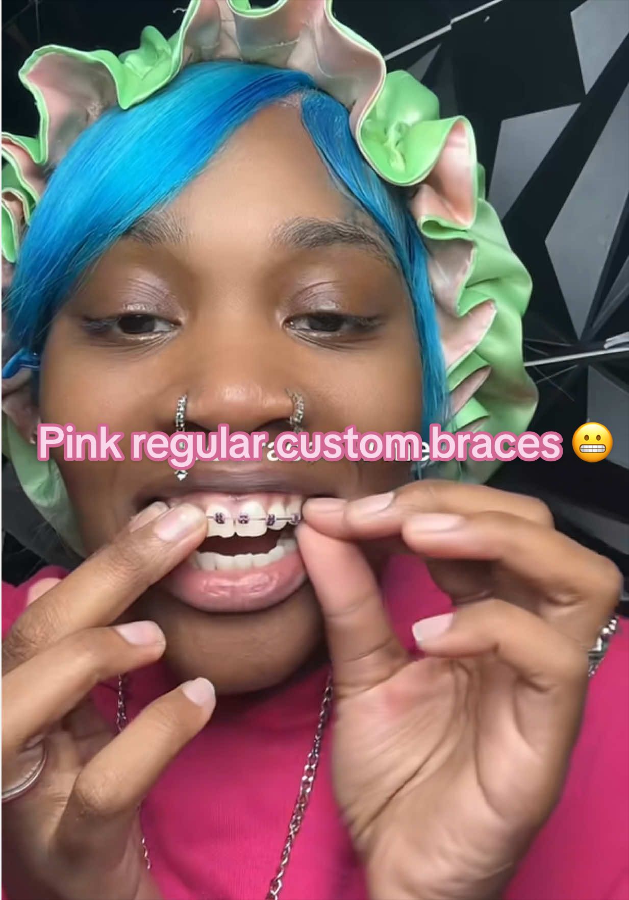 @Princessbracesplug🫶🏽🫆