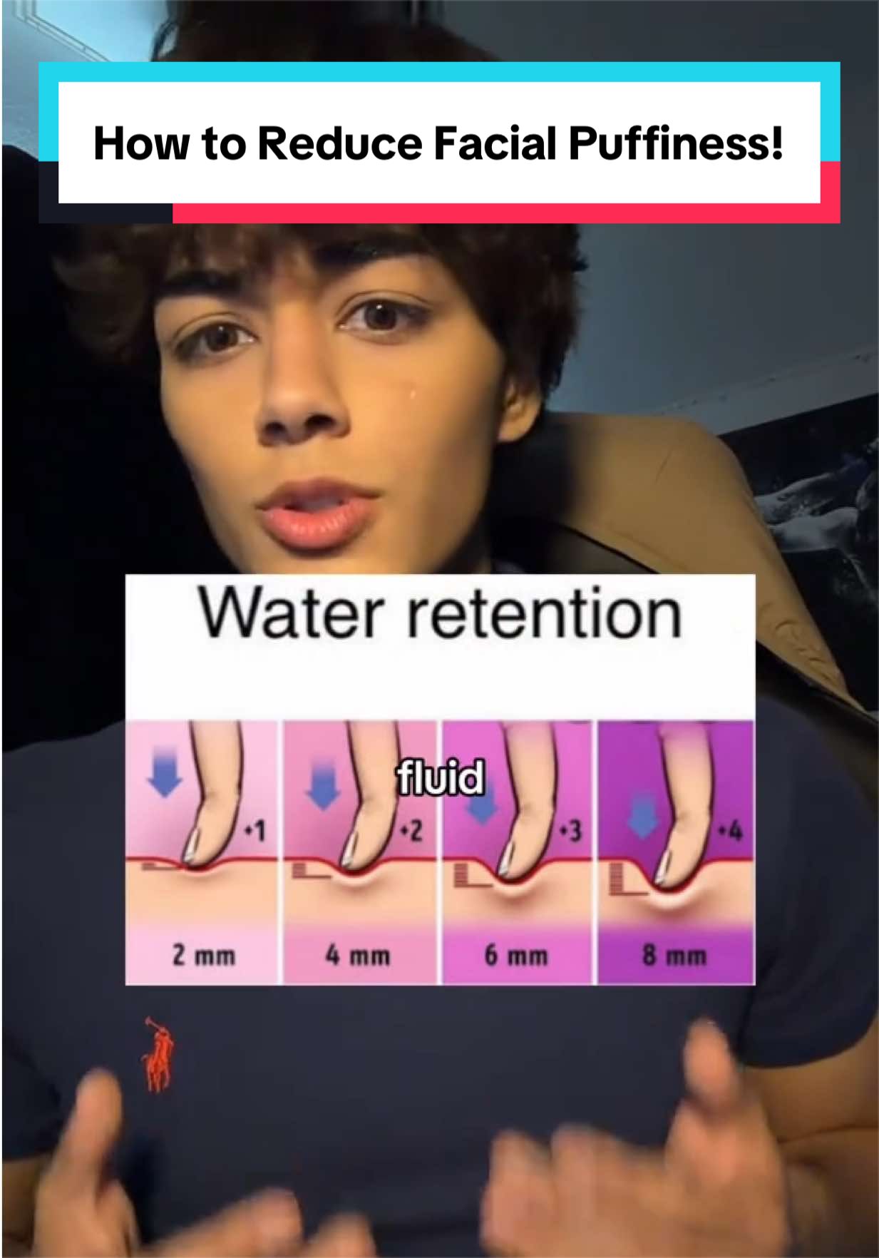 @Cam