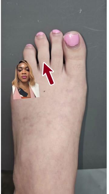 @Deniel Foot and Ankle Center