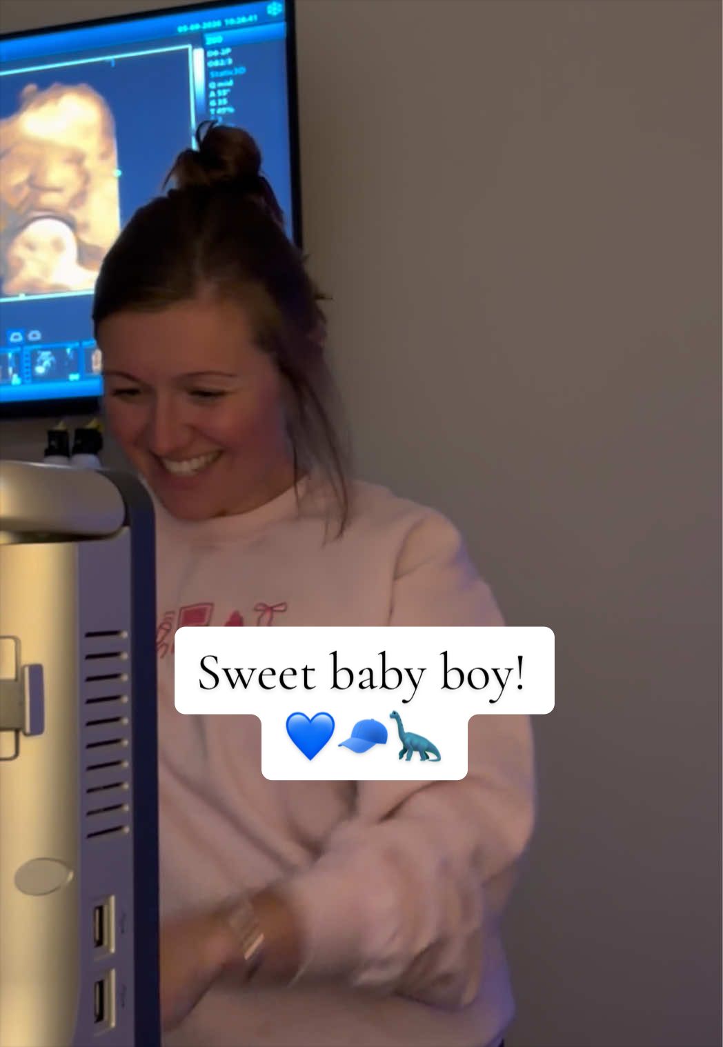 @Brandi | The Ultrasound Girl ✨