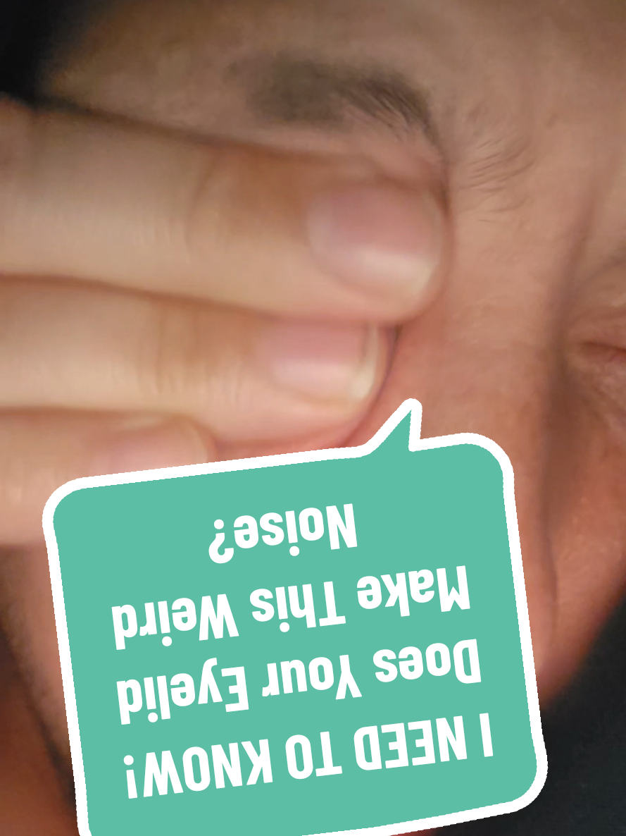 @RareOrion