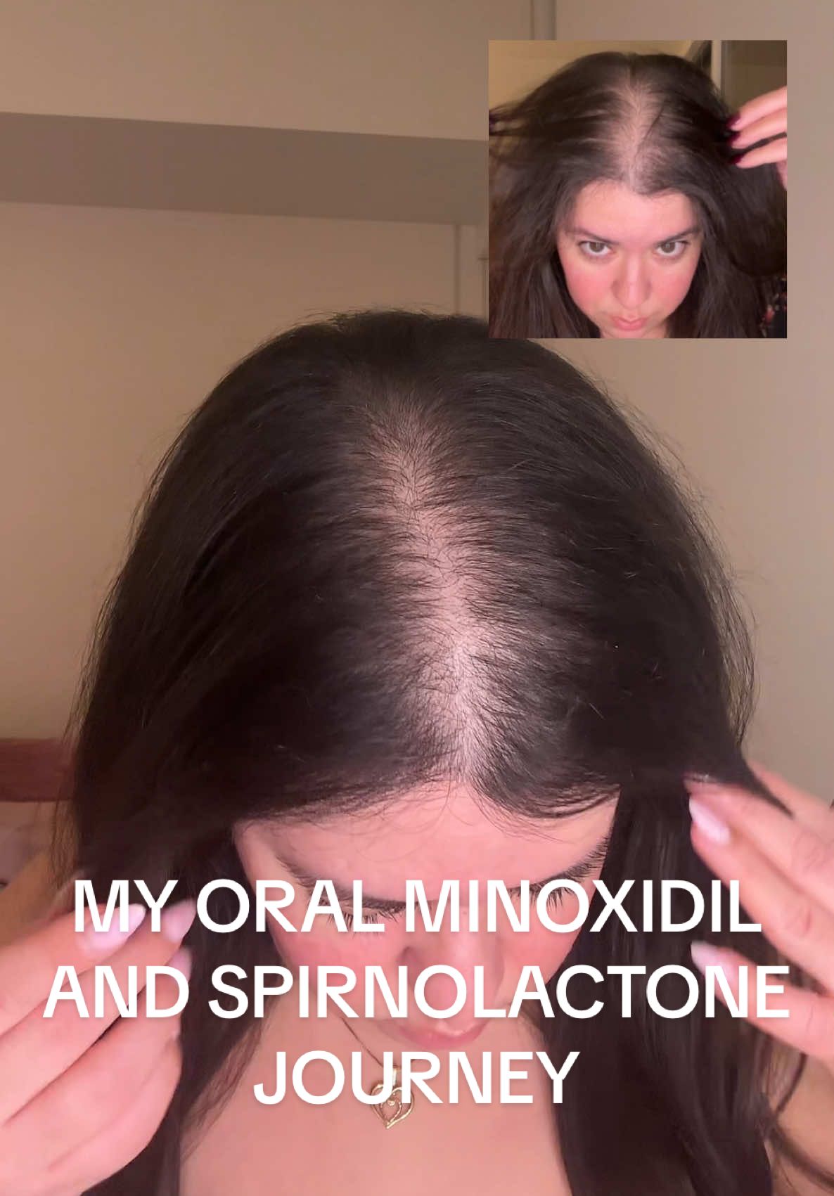 @Bianca