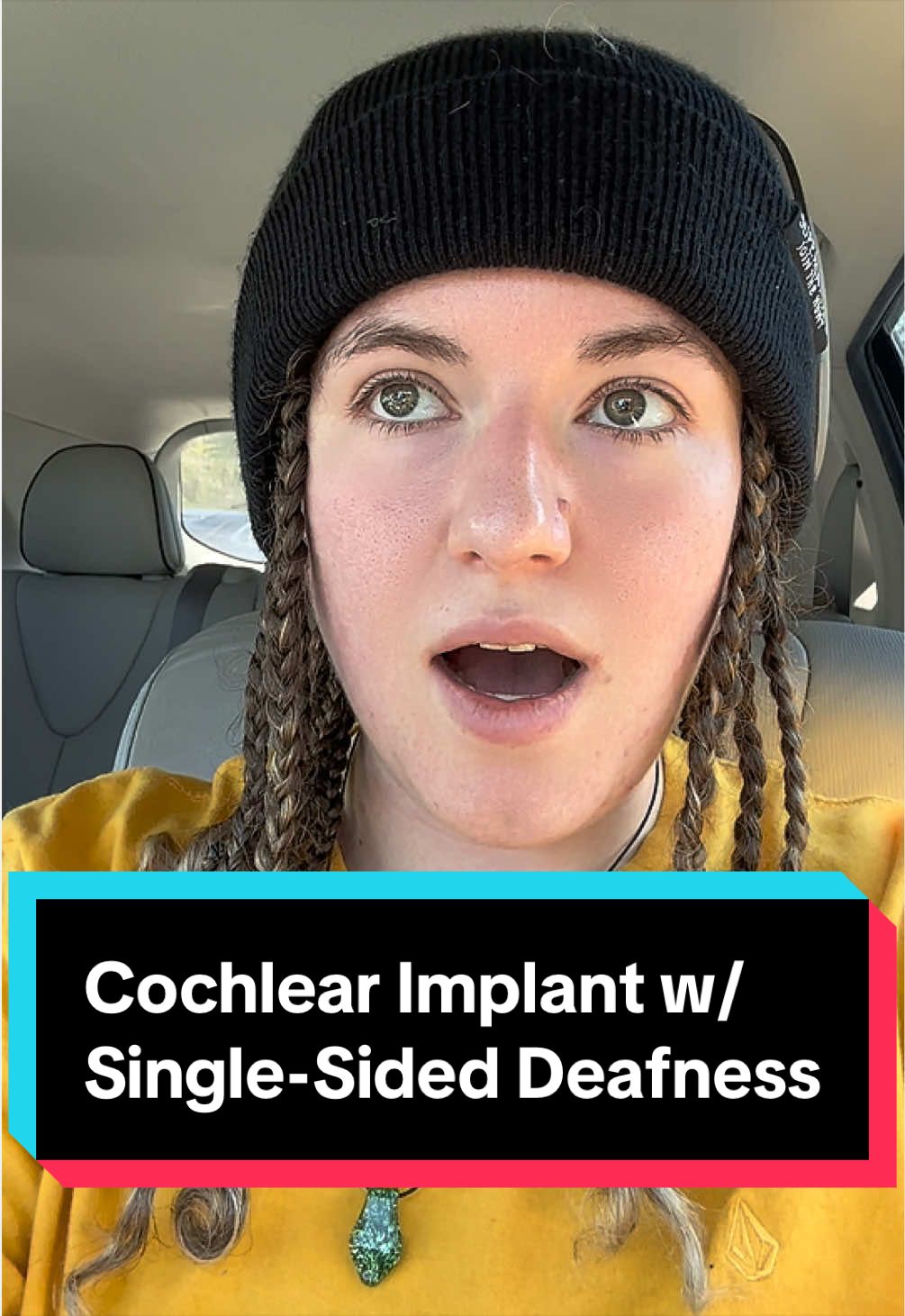 @Rian 🦻🏳️⚧️