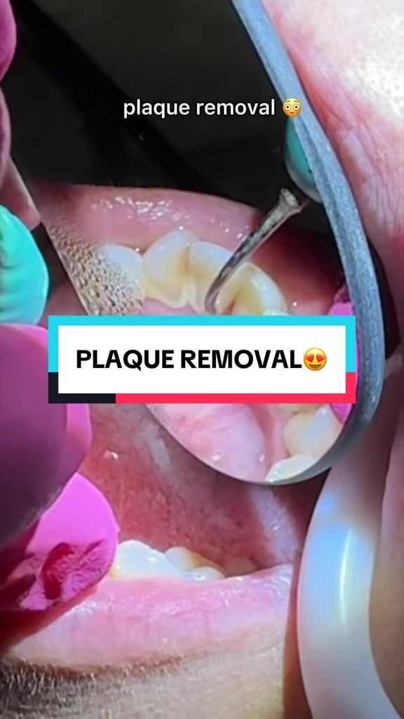 @TikTok Dentist
