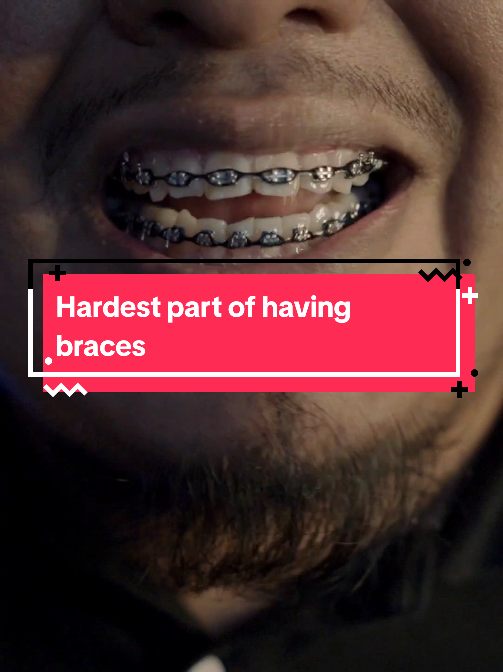 @str8braces