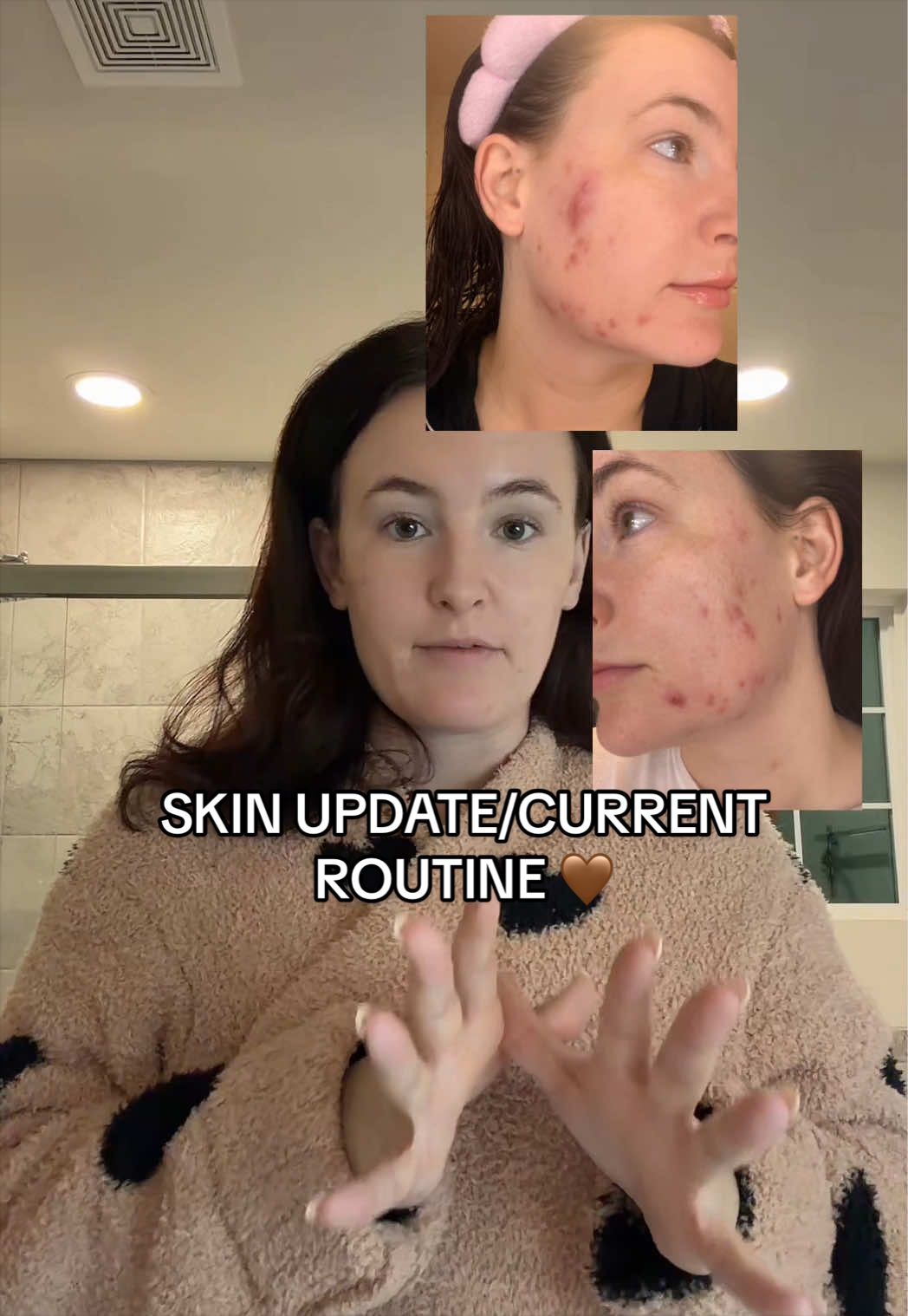 @Sara