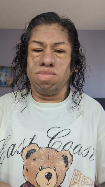 @Yessimperfections