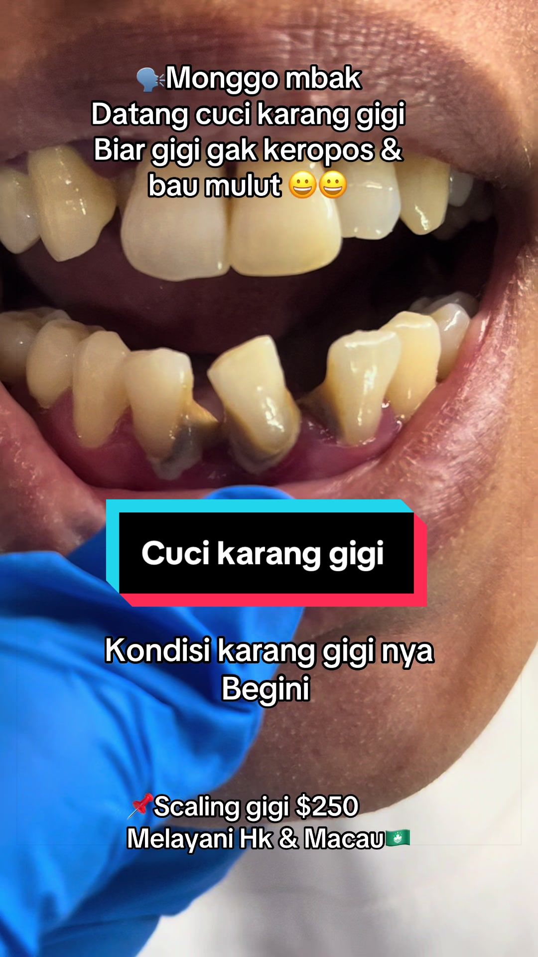 @mbak-Paijem