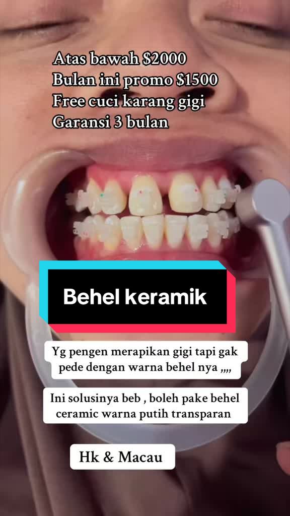@mbak-Paijem