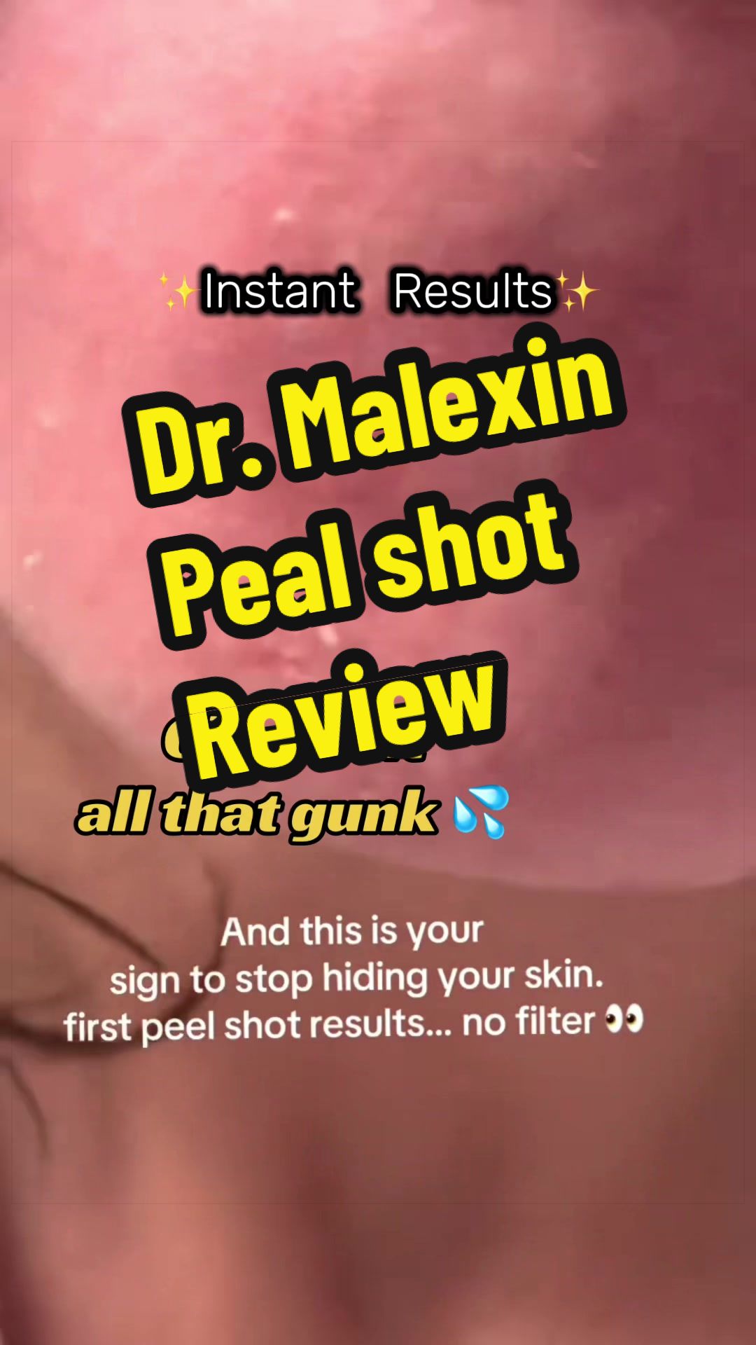 @DealsOnDeals