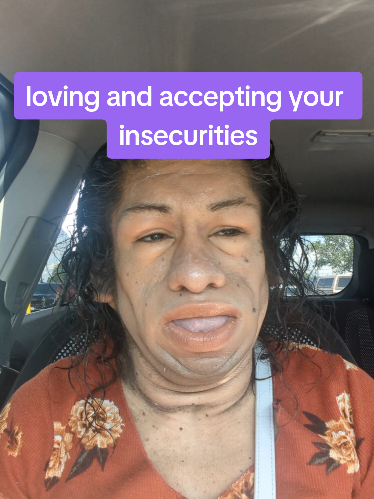 @Yessimperfections
