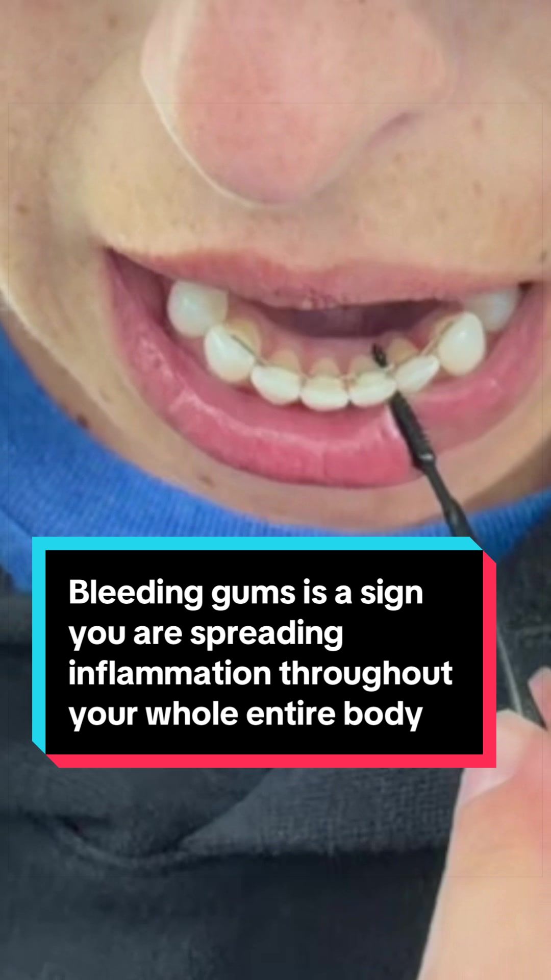 @Kellee • Dental Hygienist