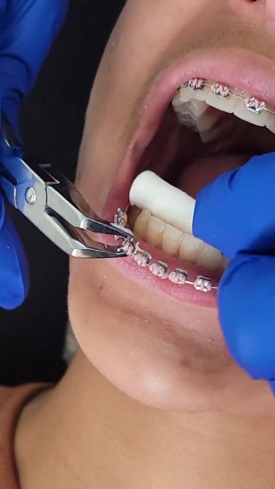@SmileEnvyDental
