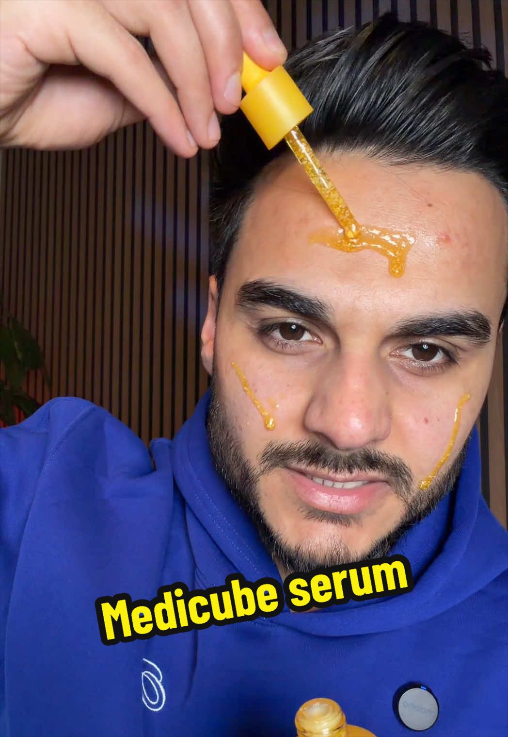 @Ferdieshops