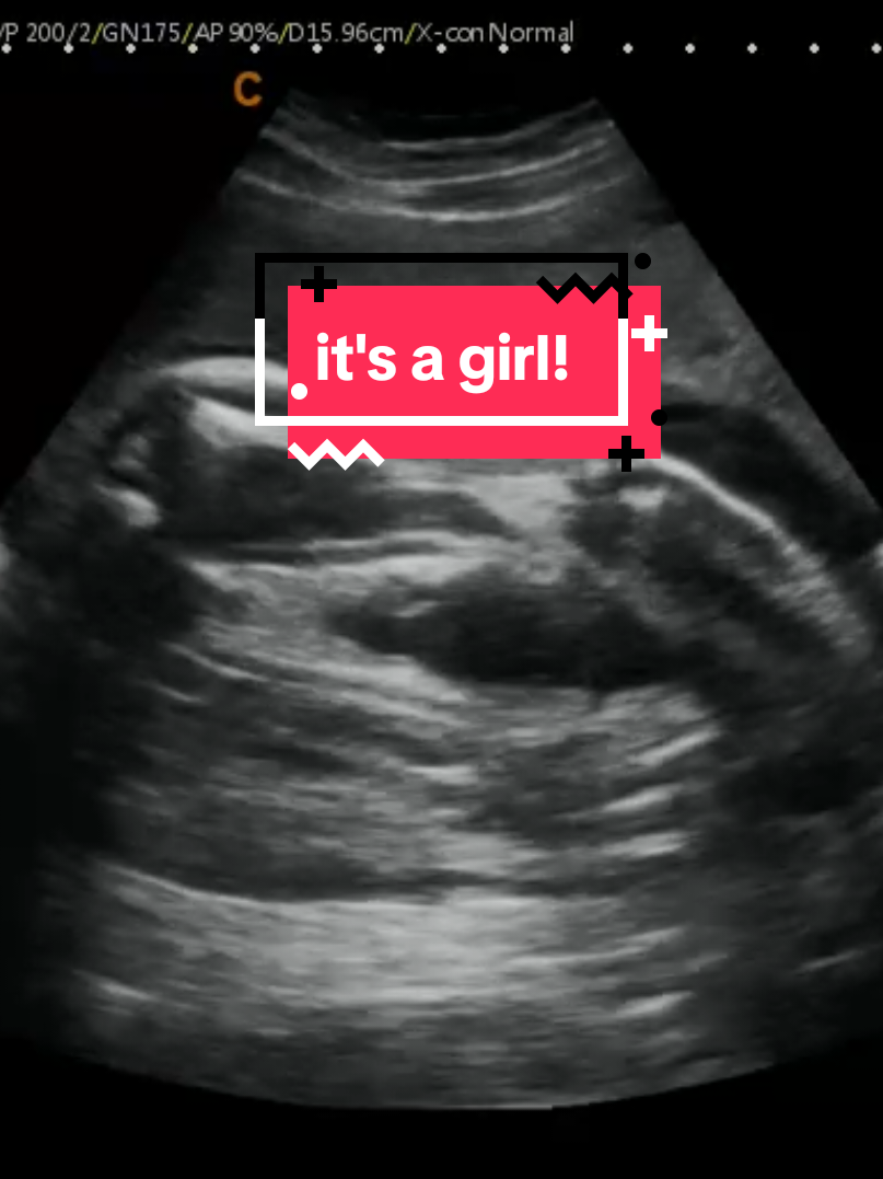 @Hey, Baby!