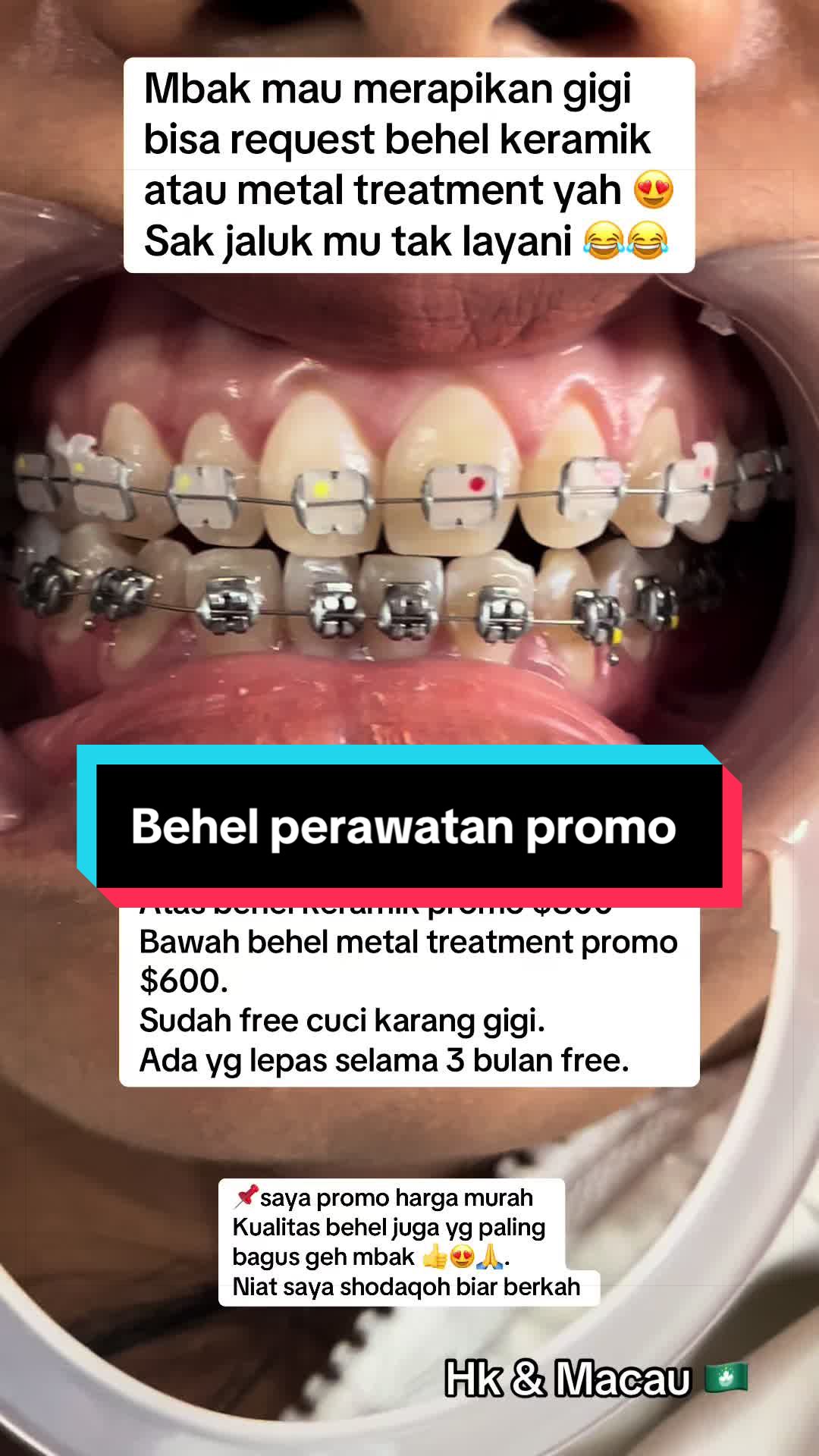 @mbak-Paijem