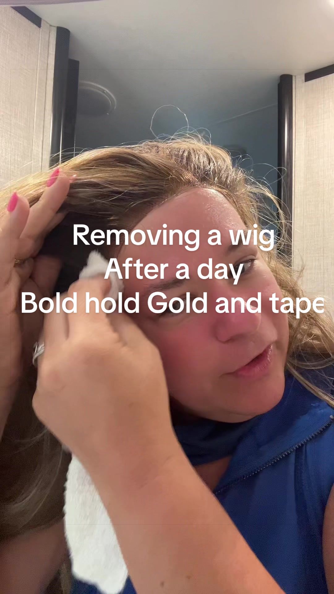 @wignurse