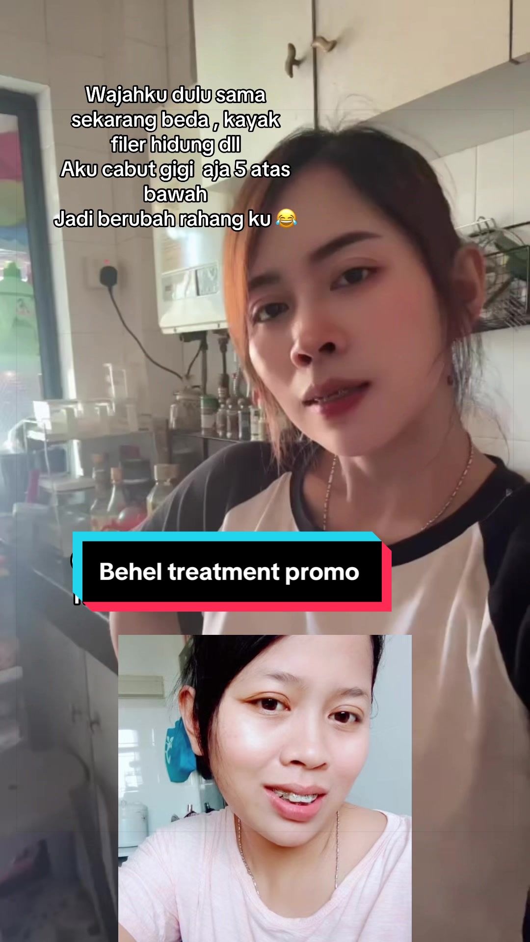 @mbak-Paijem
