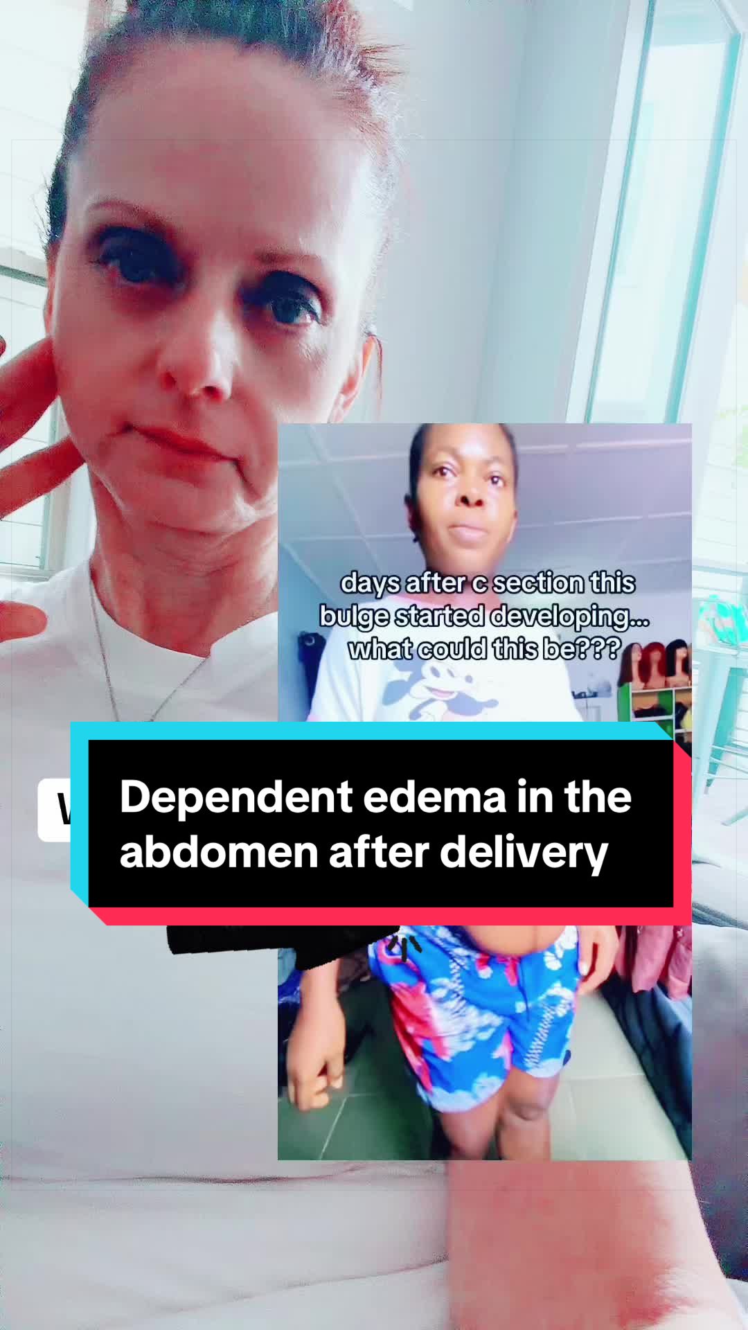 @Shannon M. Clark, MD, FACOG