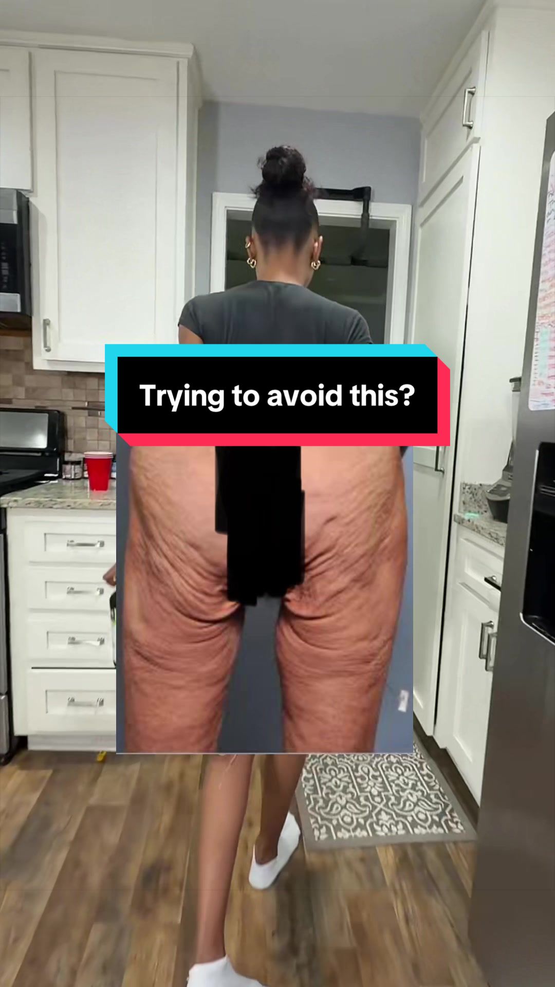 @🆎