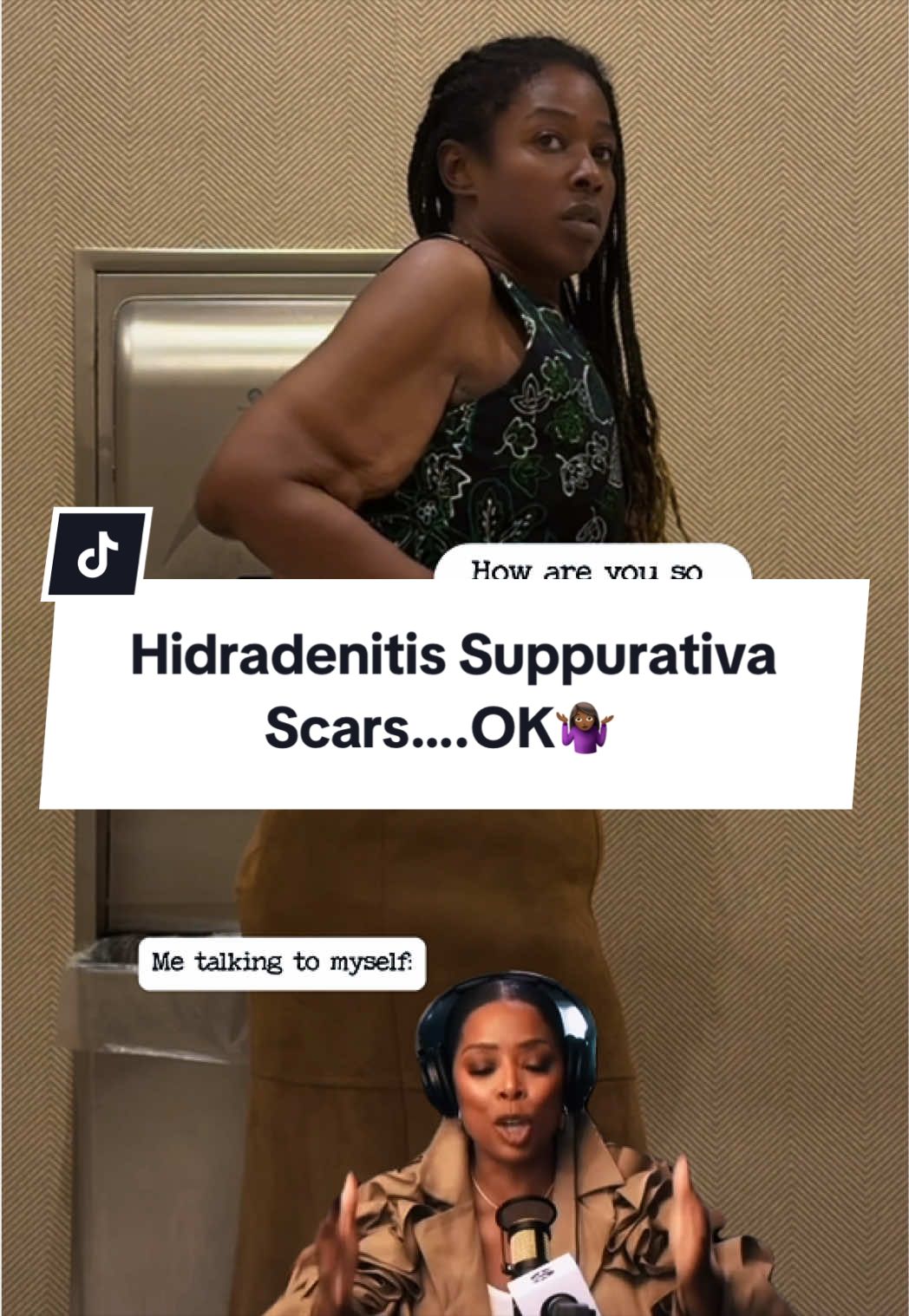 @Hidradenitis & Relief