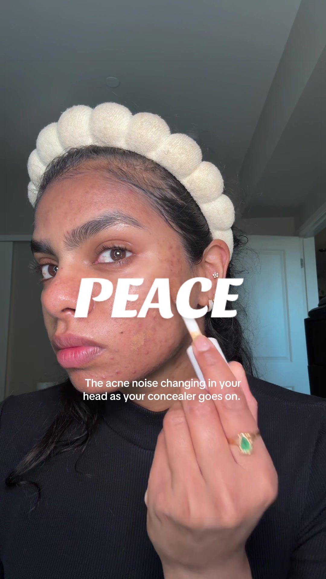 @Nyx Curations | Acne +Wellness