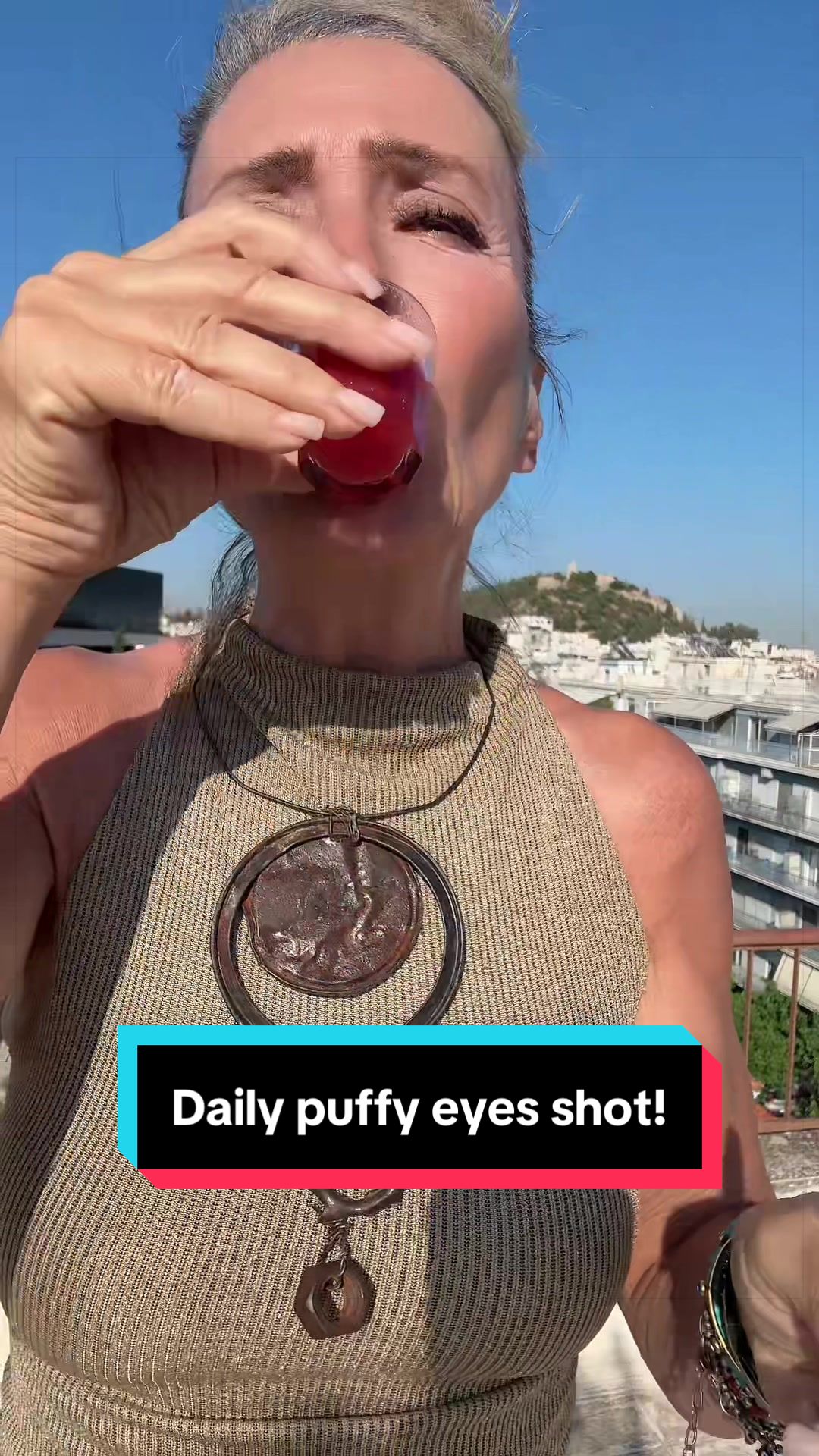 @Vicky DeRosa
