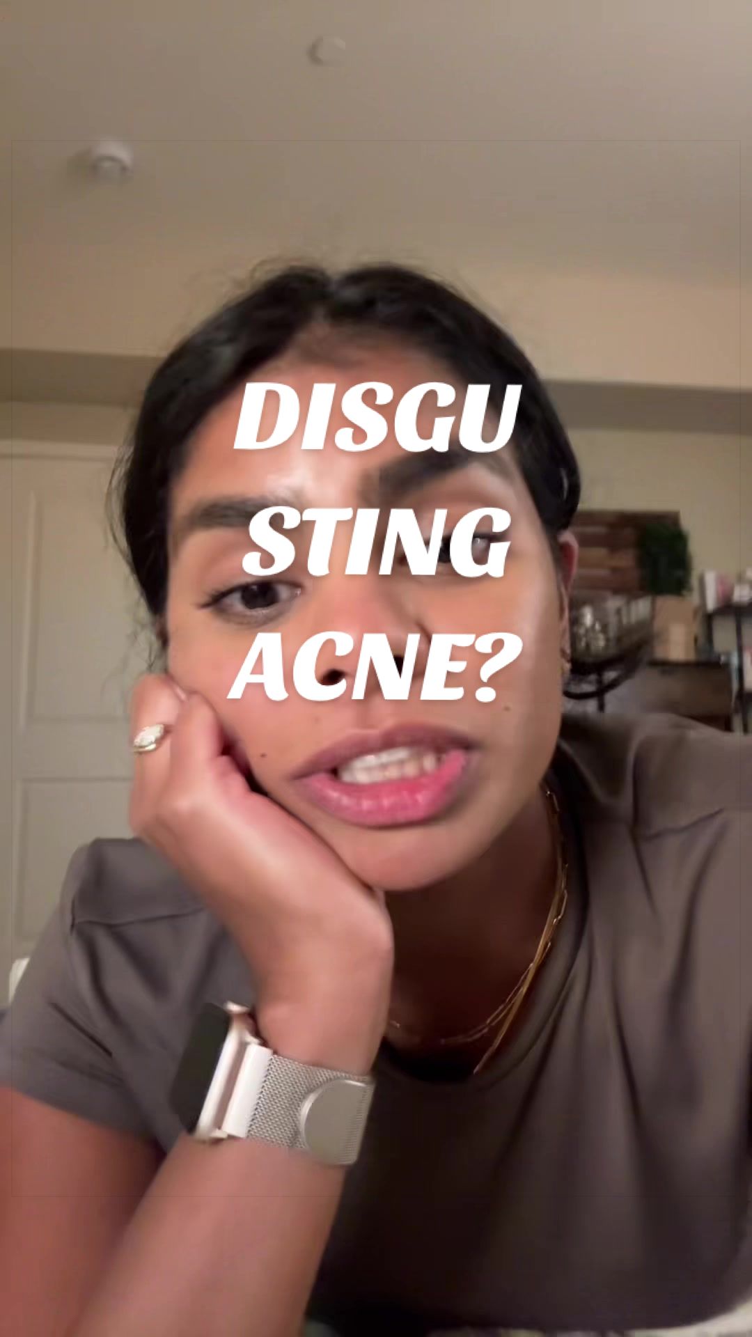@Nyx Curations | Acne +Wellness