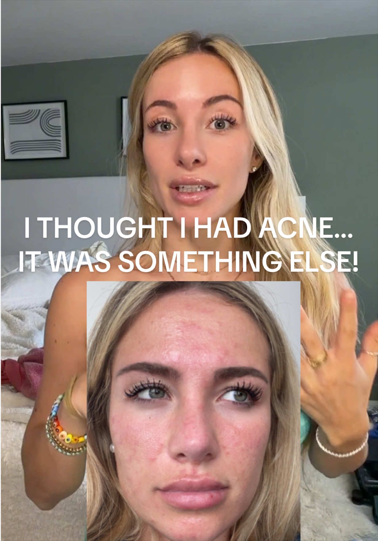 @VANESSA CLOVER