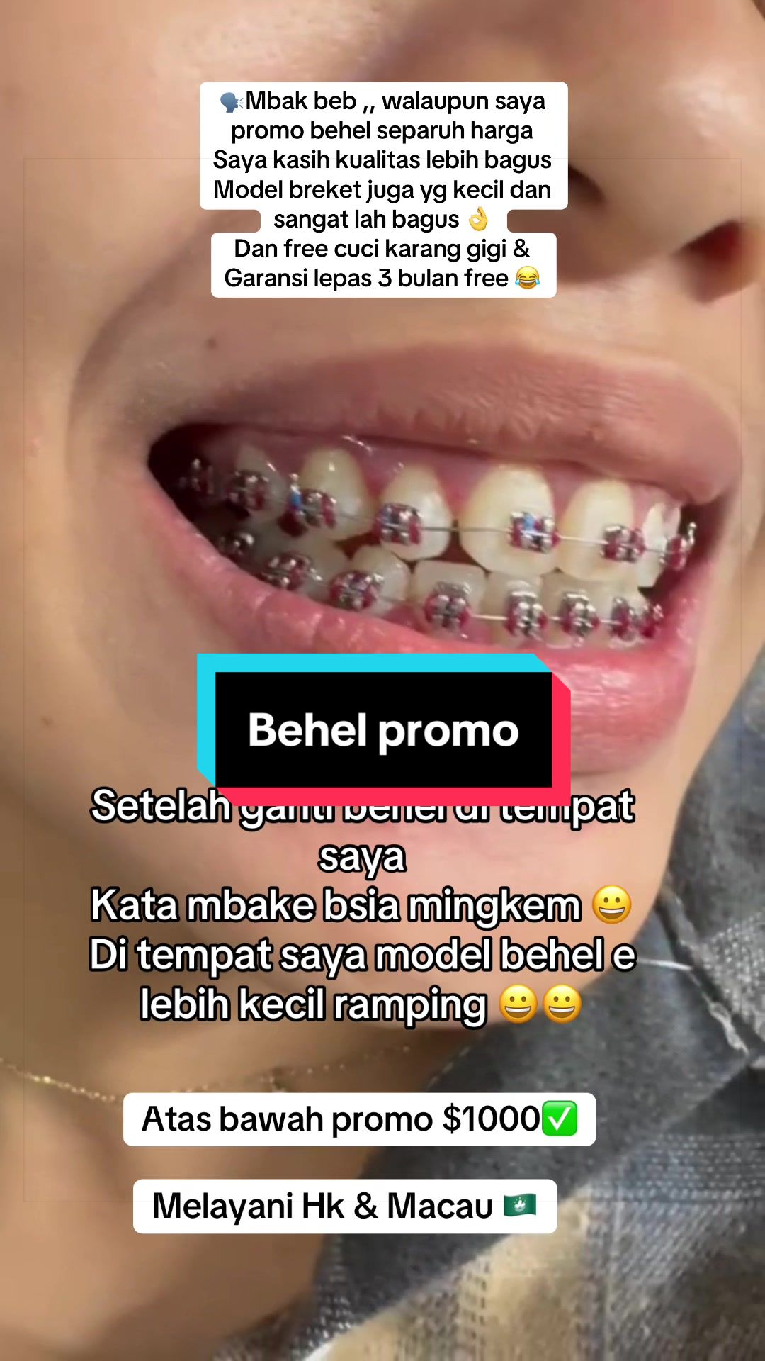 @mbak-Paijem