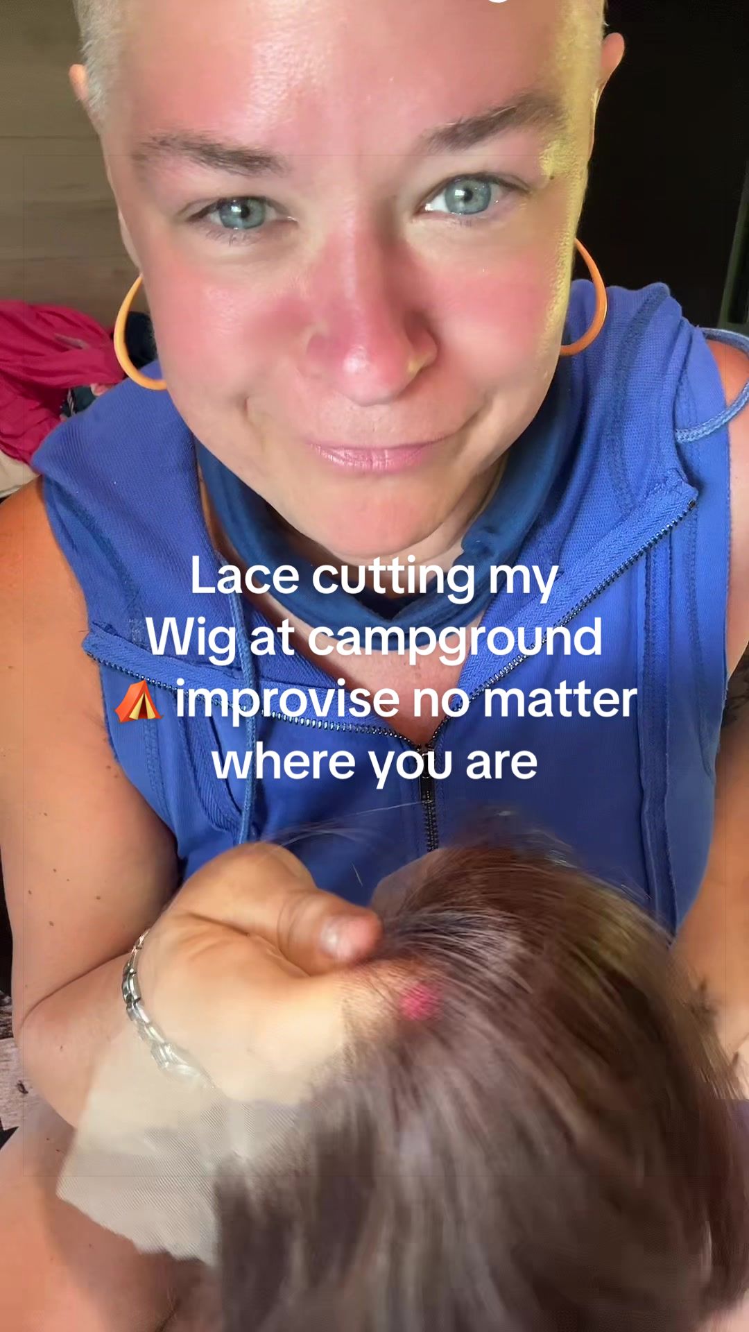 @wignurse