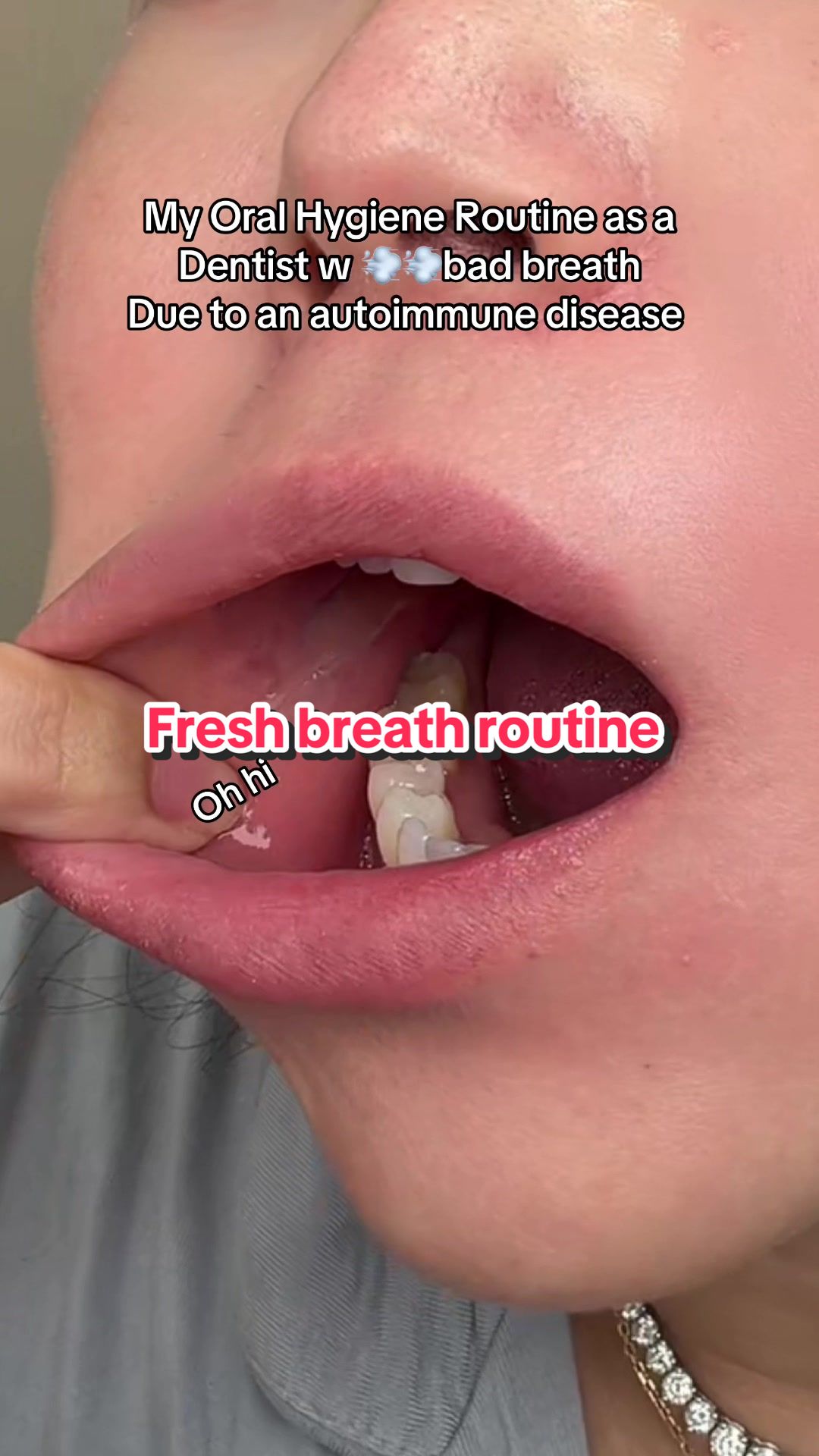 @Joycethedentist
