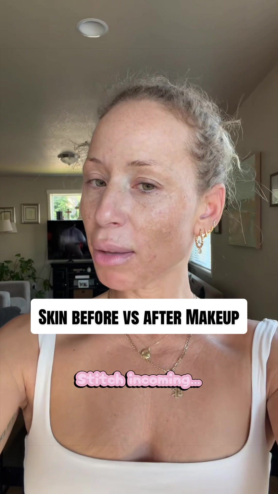 @Botox Filler Skin Los Angeles