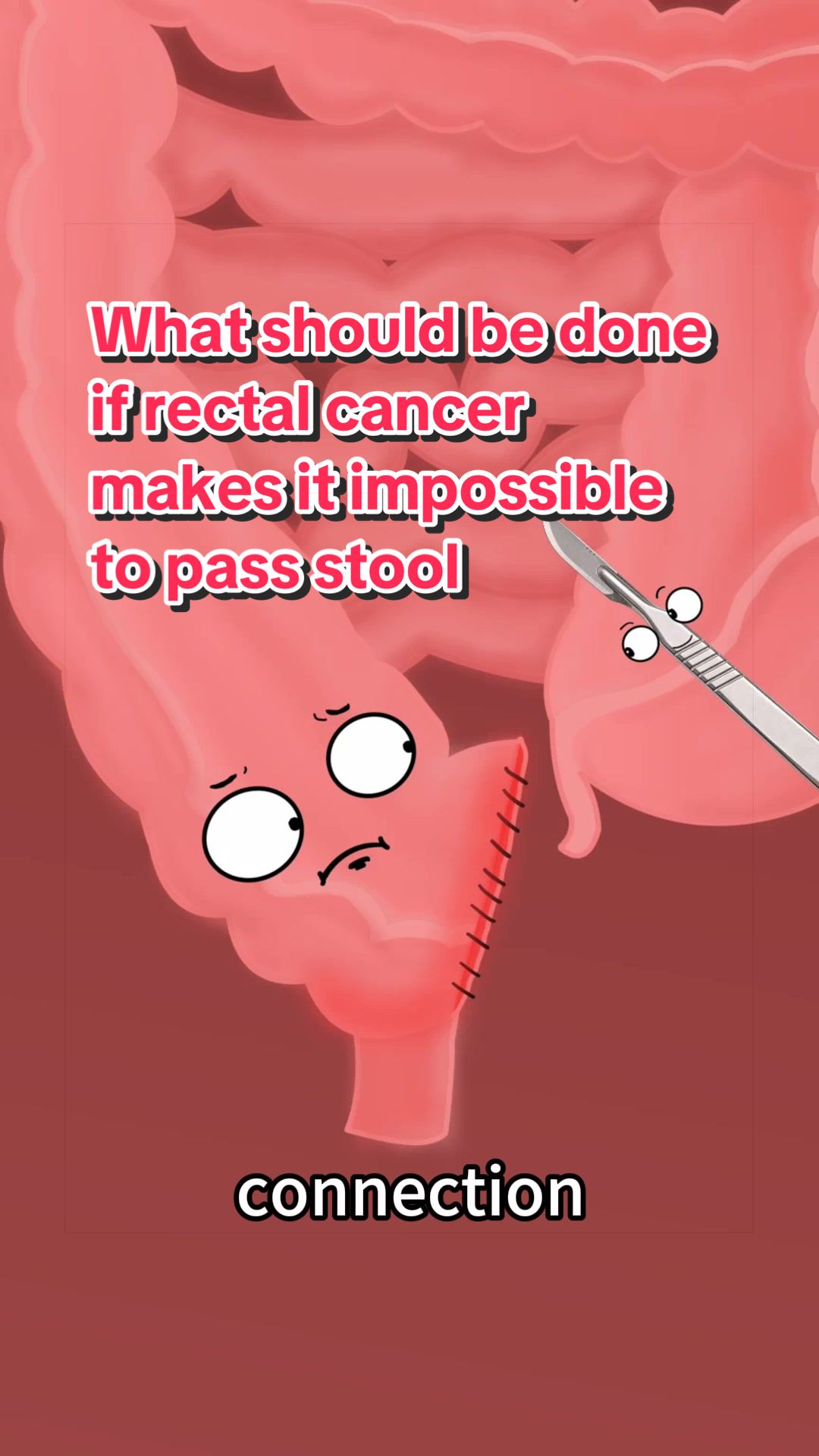 @Funny Animations