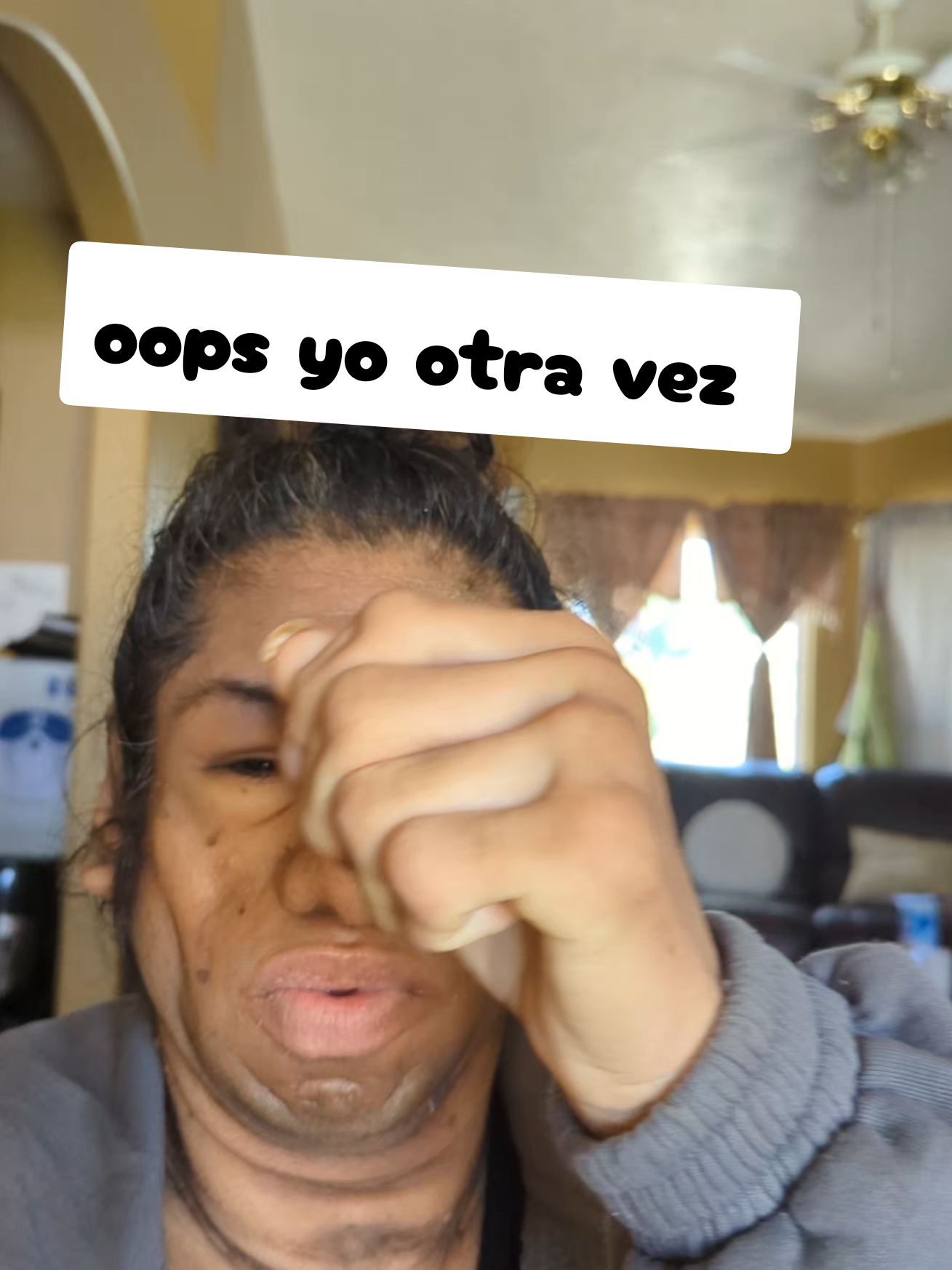 @Yessimperfections