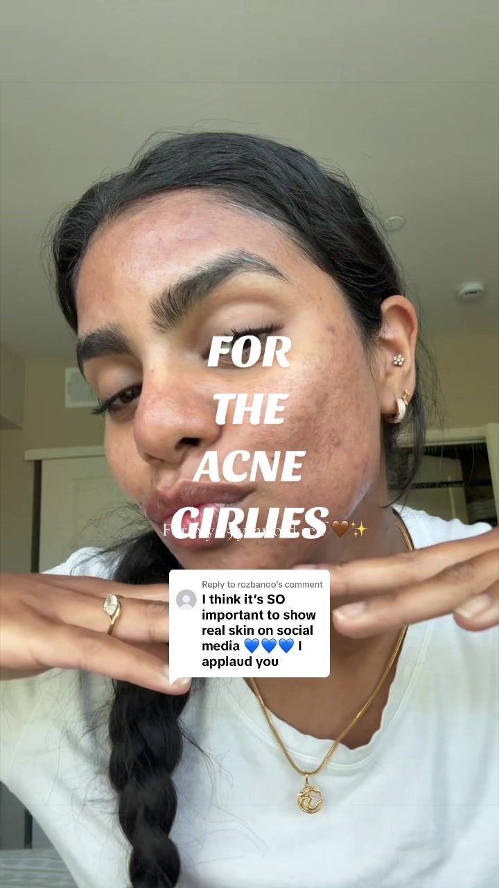 @Nyx Curations | Acne +Wellness